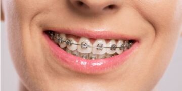 Los españoles se quedan sin dentista por las limitaciones económicas