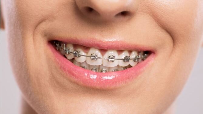 Los españoles se quedan sin dentista por las limitaciones económicas