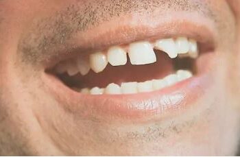 Los españoles se quedan sin dentista por las limitaciones económicas