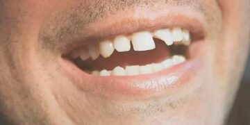 Los españoles se quedan sin dentista por las limitaciones económicas