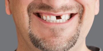 Los españoles se quedan sin dentista por las limitaciones económicas