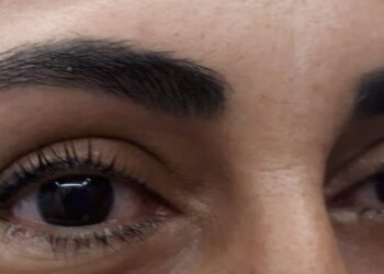 Centro de estética en Astillero especializado en estética de la mirada