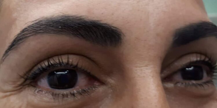 Centro de estética en Astillero especializado en estética de la mirada