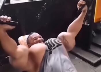 Retrasados mentales se inyectan aceite para parecer culturistas