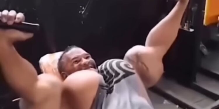 Retrasados mentales se inyectan aceite para parecer culturistas