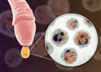 Aumento de las enfermedades de transmisión sexual en Cantabria