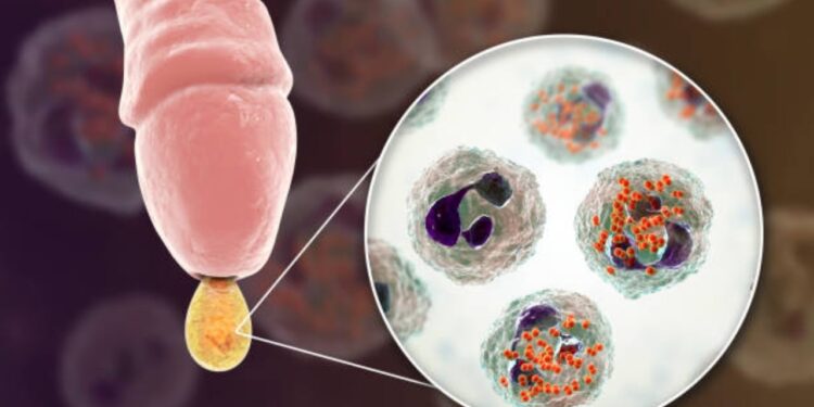 Aumento de las enfermedades de transmisión sexual en Cantabria