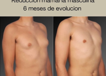 Una clínica de cirugía plástica en Cantabria apoyando el deporte base