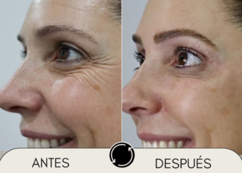 Una clínica de cirugía plástica en Cantabria apoyando el deporte base