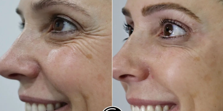 Una clínica de cirugía plástica en Cantabria apoyando el deporte base